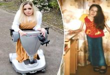 Photo of 30 सालों से नही बैठ पाई है 32 साल की जोआना, इस दुर्लभ बीमारी से है ग्रसित