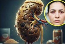 Photo of Kidney Damage symptoms: आंखों में दिखता है किडनी डैमेज का लक्षण, इग्नोर करना पड़ेगा भारी