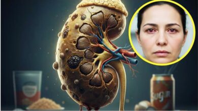 Photo of Kidney Damage symptoms: आंखों में दिखता है किडनी डैमेज का लक्षण, इग्नोर करना पड़ेगा भारी
