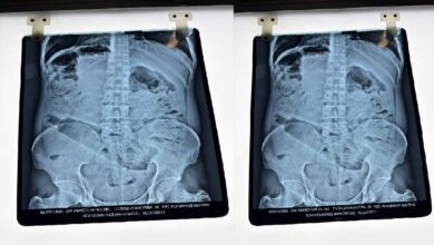 Photo of अम्बेडकरनगर में हैरान करने वाला मामला: नशे में युवक ने प्राइवेट पार्ट में डाली बोतल, दर्द से अस्पताल भागा